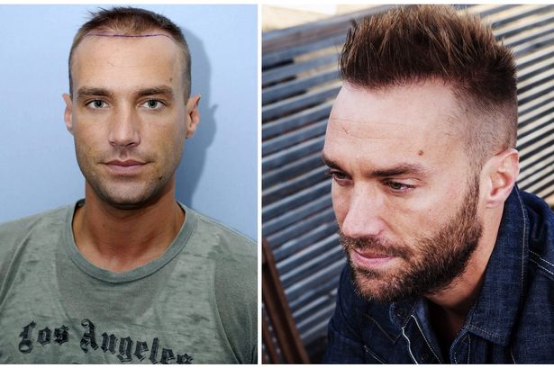calum-best-comp.jpg