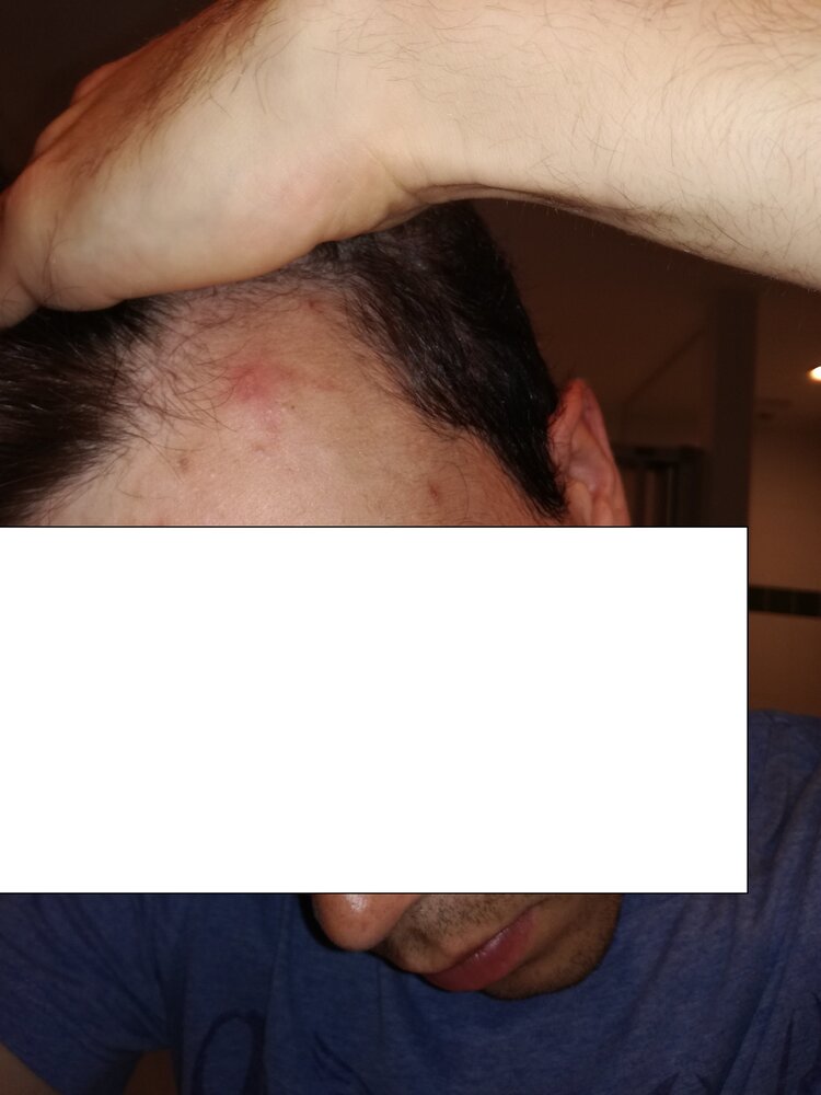 calvasse4ans.jpg