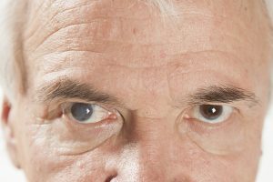 Cataracts-300x200.jpg