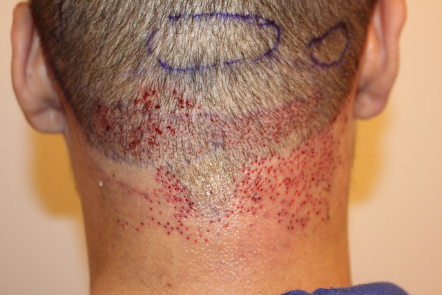Center-Post-Op.jpg