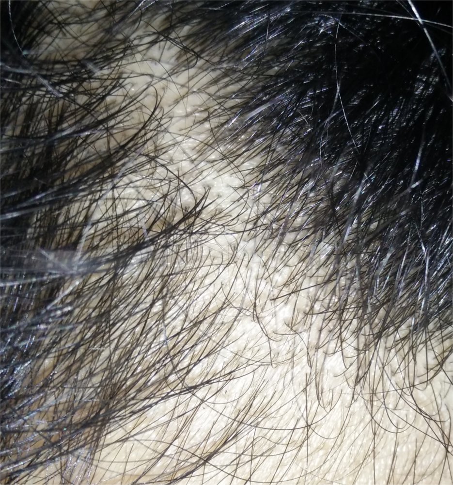 close up1.jpg