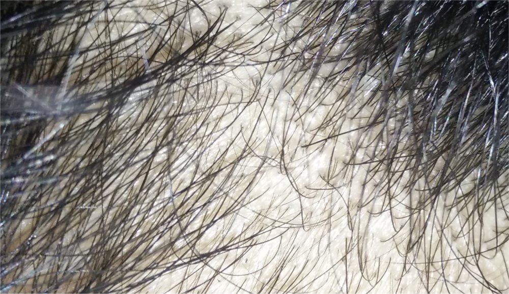 closeup2-1.jpg