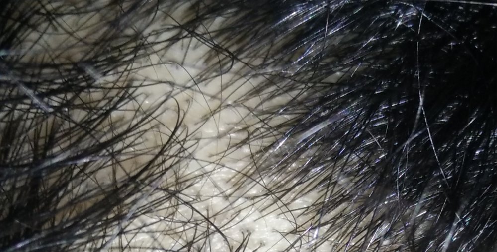 closeup2-2.jpg