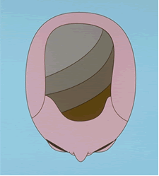 depleted-supply-fig3.gif
