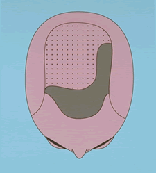 depleted-supply-fig4.gif