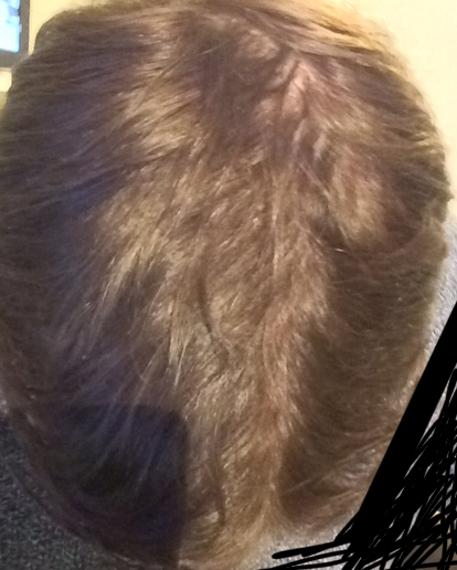 diffuse_thn.jpg