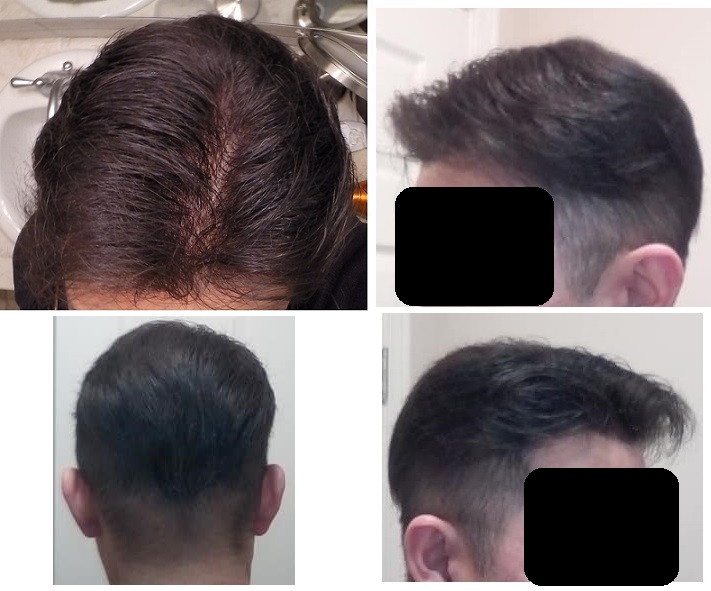 dsna7rj-jpg.jpg