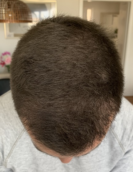Efter.1.jpg