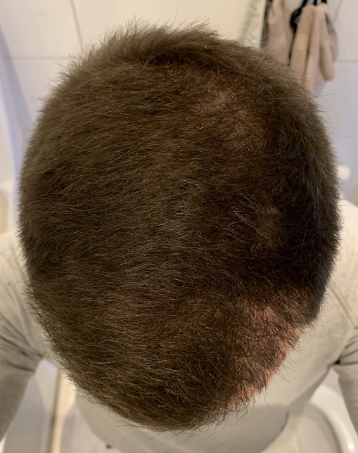 Efter.3.jpg
