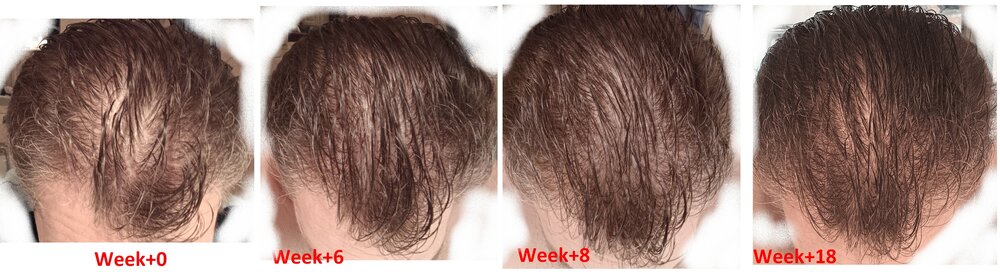 Evolution_s0_s18_cheveux_mouilles.jpg