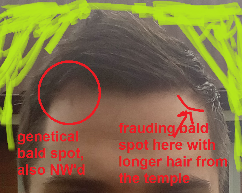 fdfdddd-png.png