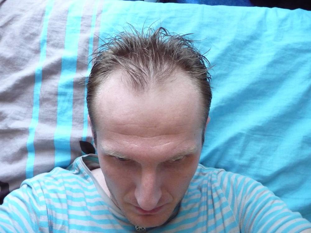 first_before.jpg