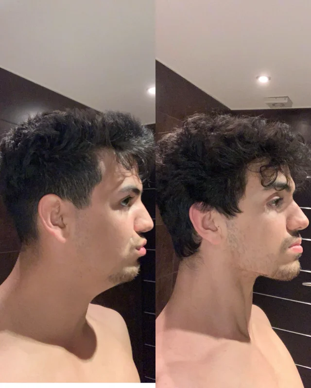 Fmm1ajEmKSQJ63FiOM9p6qWdJvtNbDz8NFHoEv-Igs5nN8zS_i.png