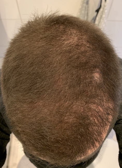 Före.3.jpg