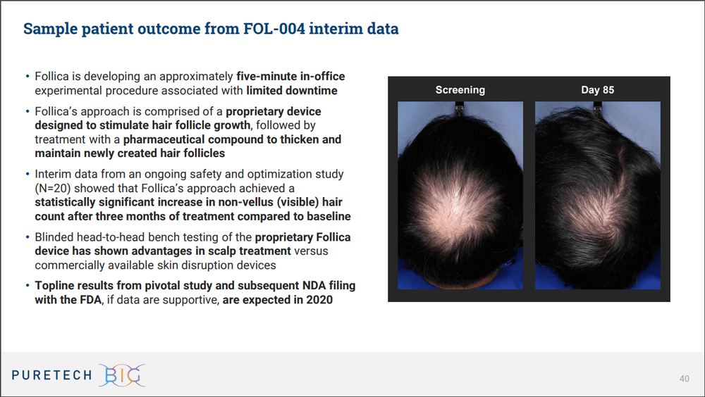Follica_Hair_Results_Before_After.png
