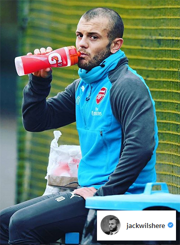 Footballer-jack-wilshere-hair-loss-thinning-hair.jpg