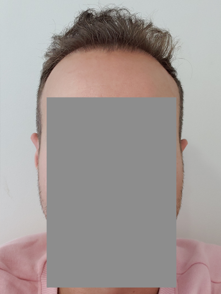 front hair copy.png