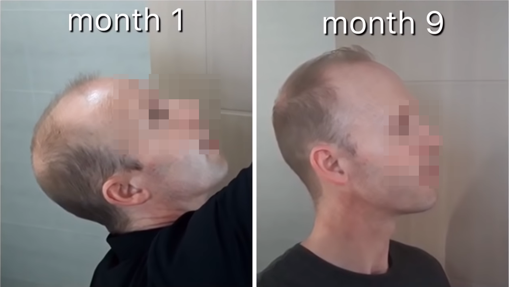 FVQzjL4.png