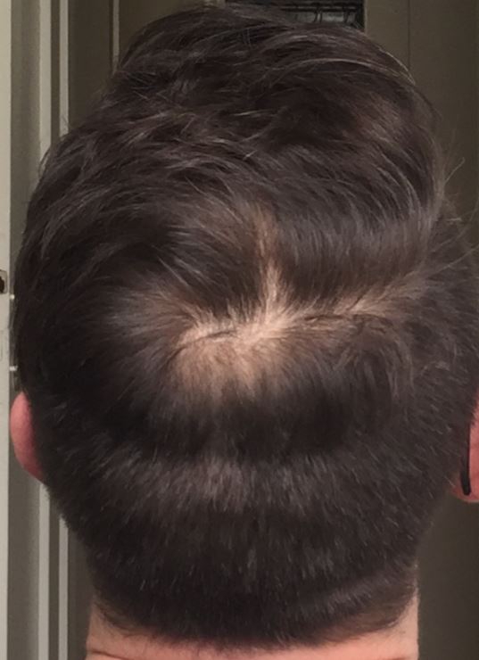 Haare_Februar_Vertex_2018.jpg