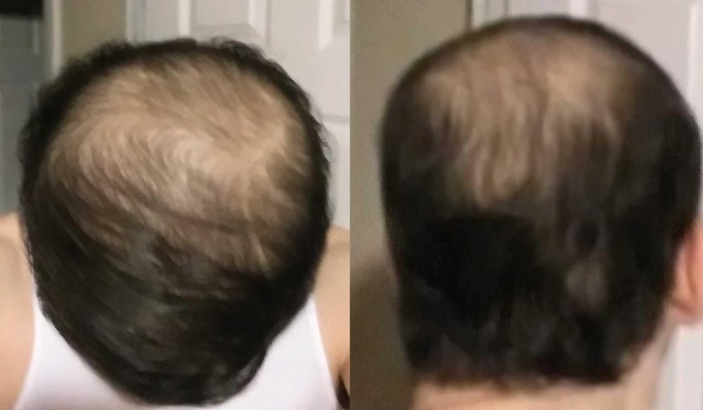 hair.jpg