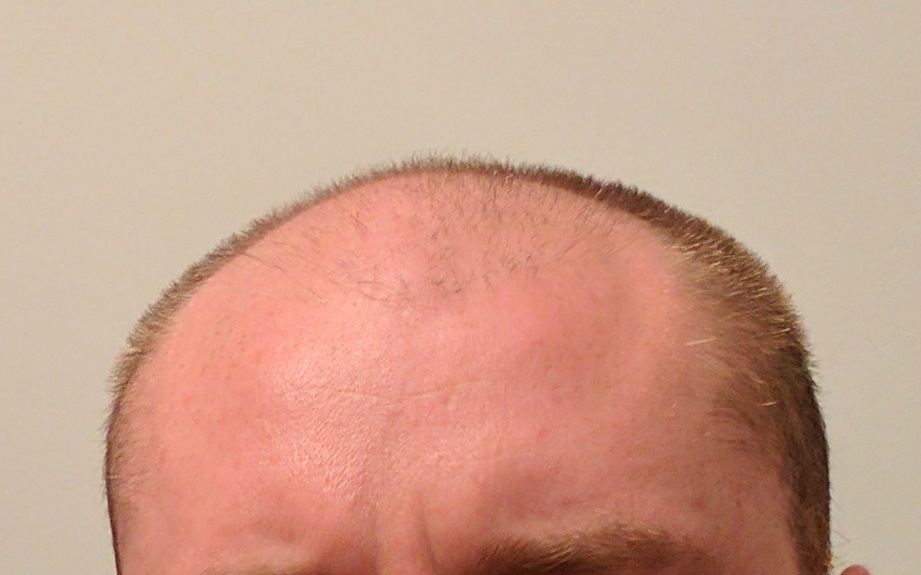 hair.jpg