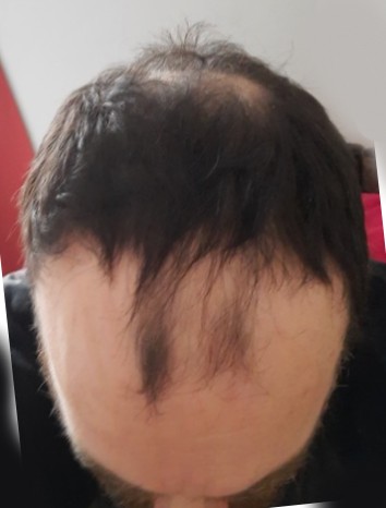 hair.jpg