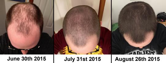 hair-progress-jpg.jpg