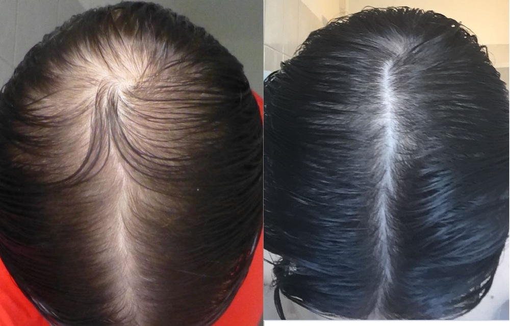 Hair_before_and_after.jpg