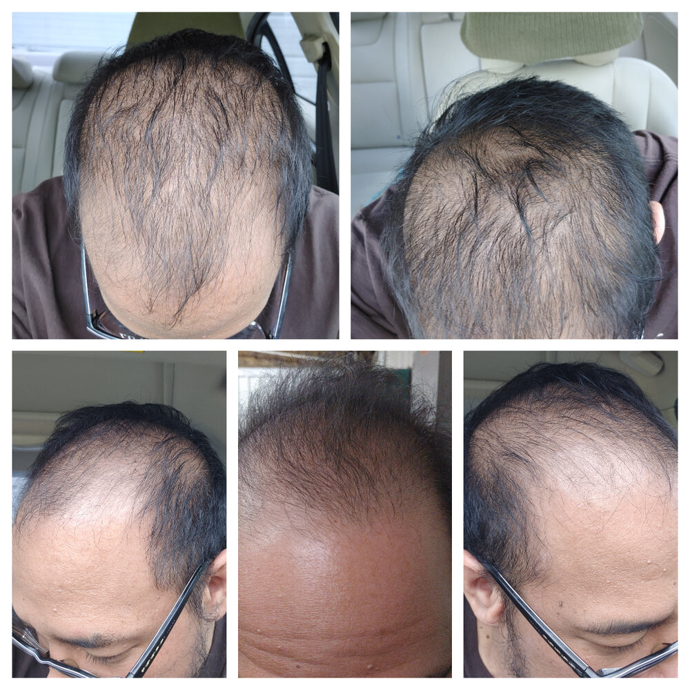 HairJourneyStart.jpg