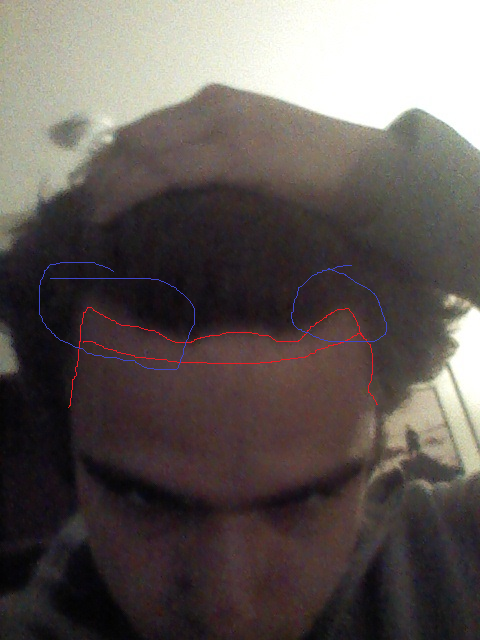 hairline.png