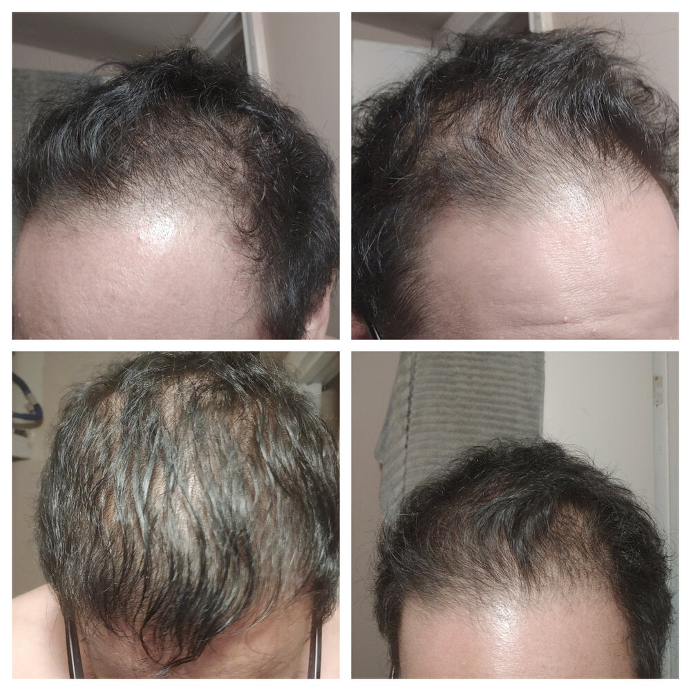 HairNow.jpg