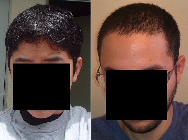 hairs.png