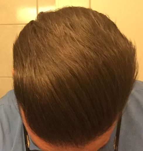 Hairs_14_Nov_2017.jpg