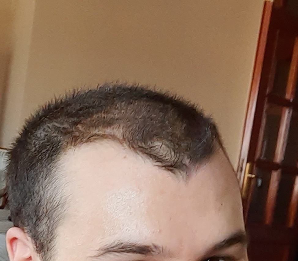 ?hash=cf779388db8d670a015ac230810b8a41.jpg