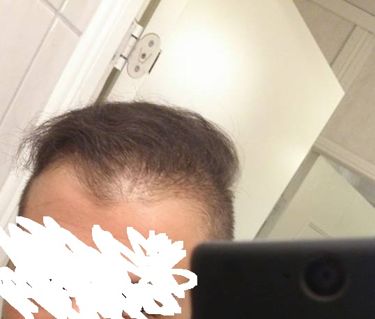 hm2-jpg.jpg