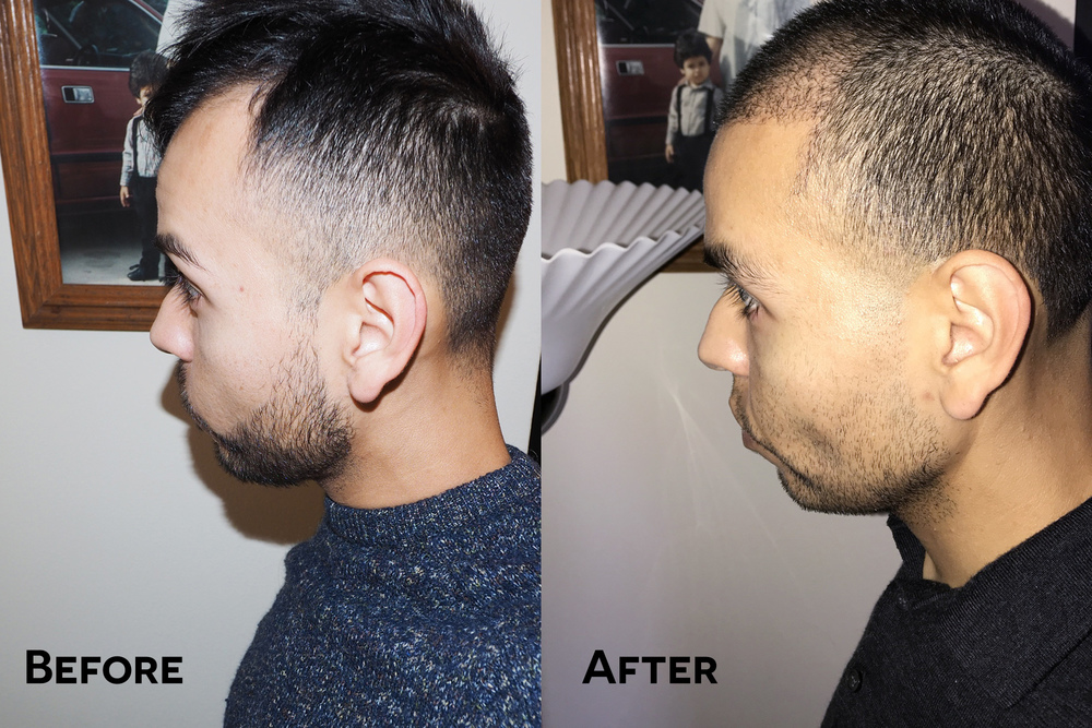 HTBefore_After.jpg