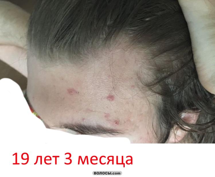 image.php.jpg