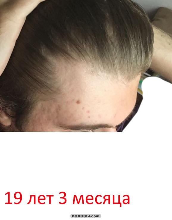 image.php.jpg
