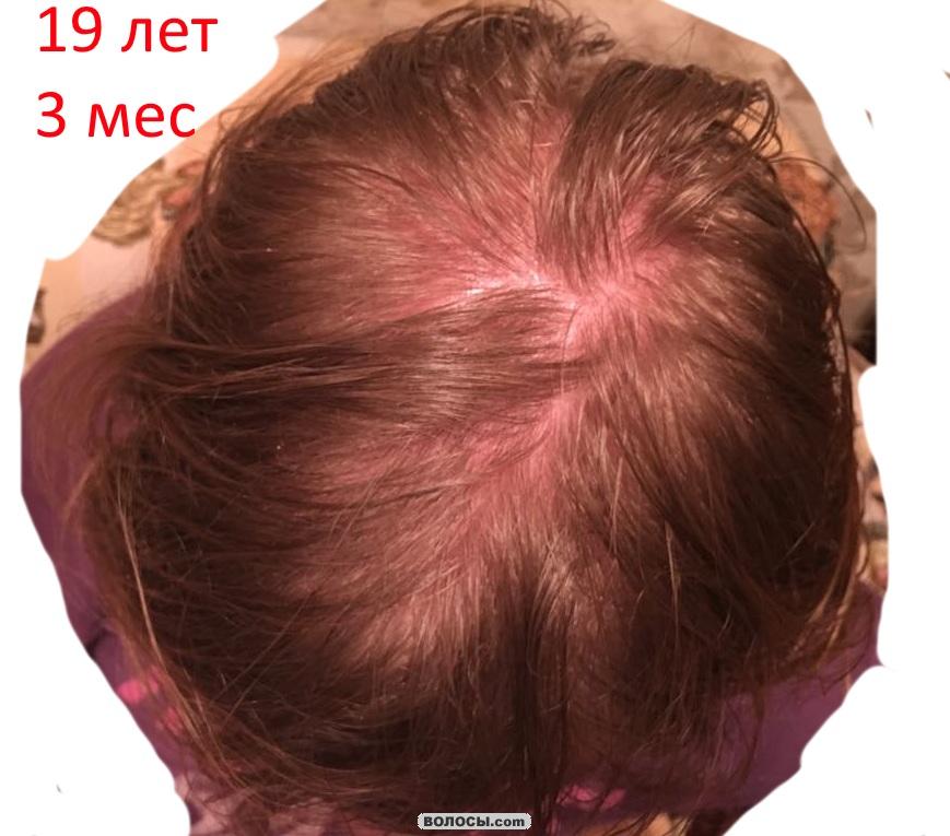 image.php.jpg