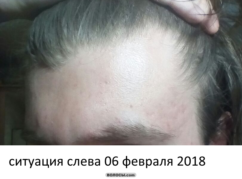 image.php.png