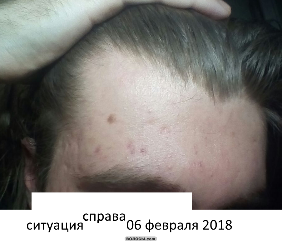 image.php.png