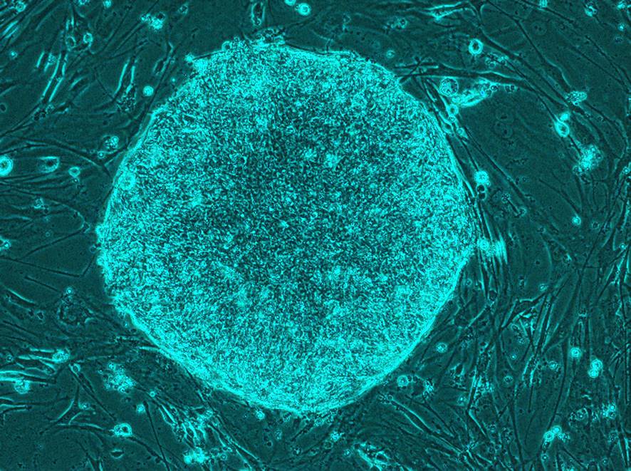 iPS-Cells-Anti-Aging-005.jpg