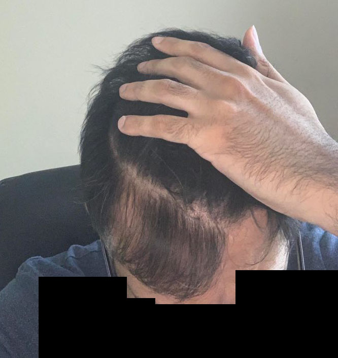 ItFijWH.jpg