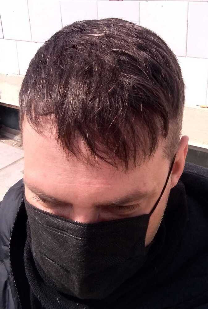 jrLozCK.jpg