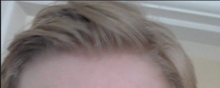 juvenile.png