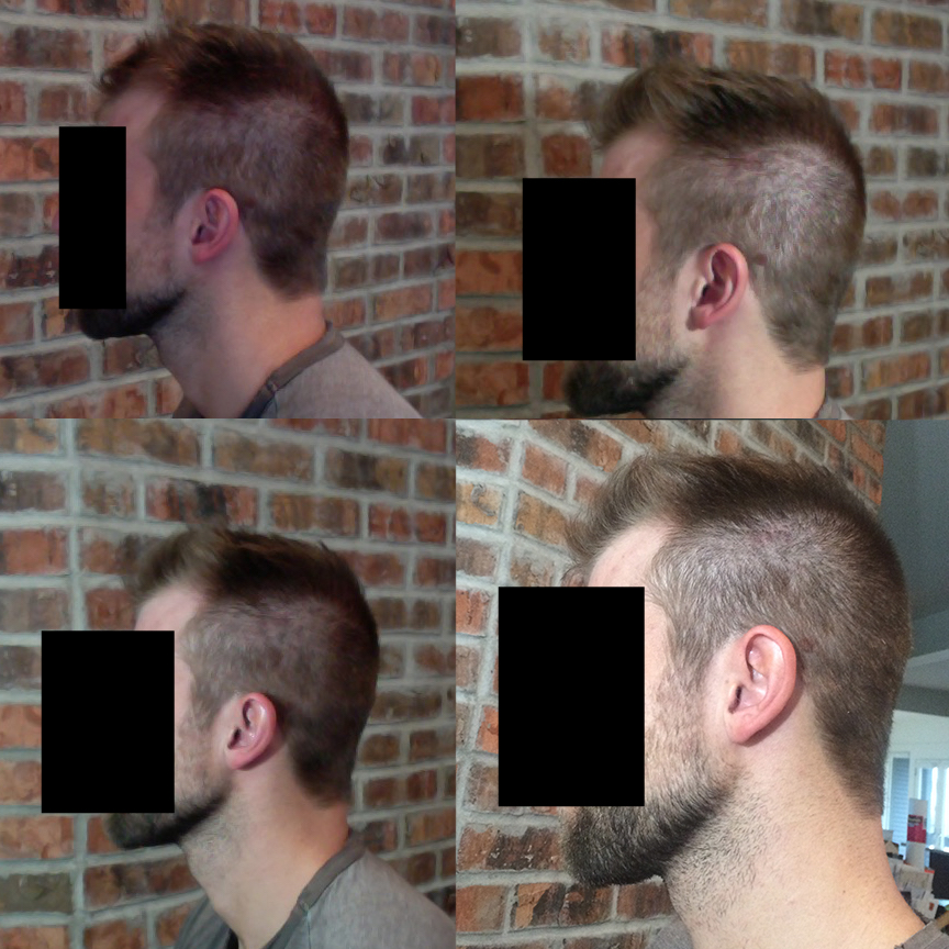 Left Side.jpg