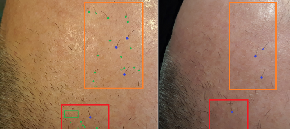 leftdec31-rightnov24-closeup-wmarkings2.png