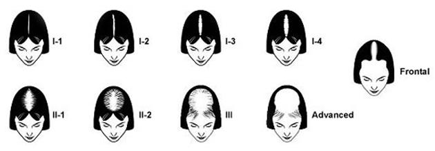 ludwig-scale-21.jpg