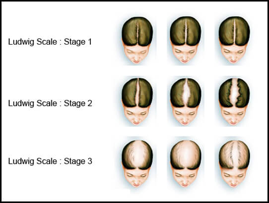 Ludwig-Scale.jpg