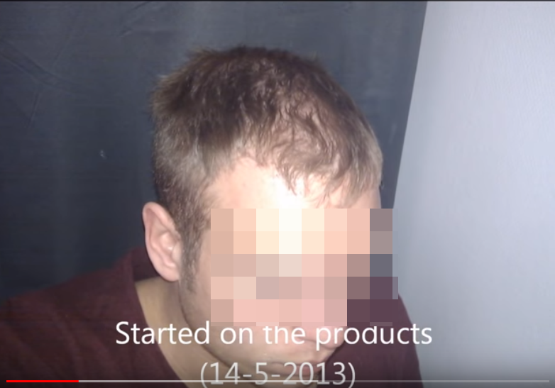 LZrPT2x.png